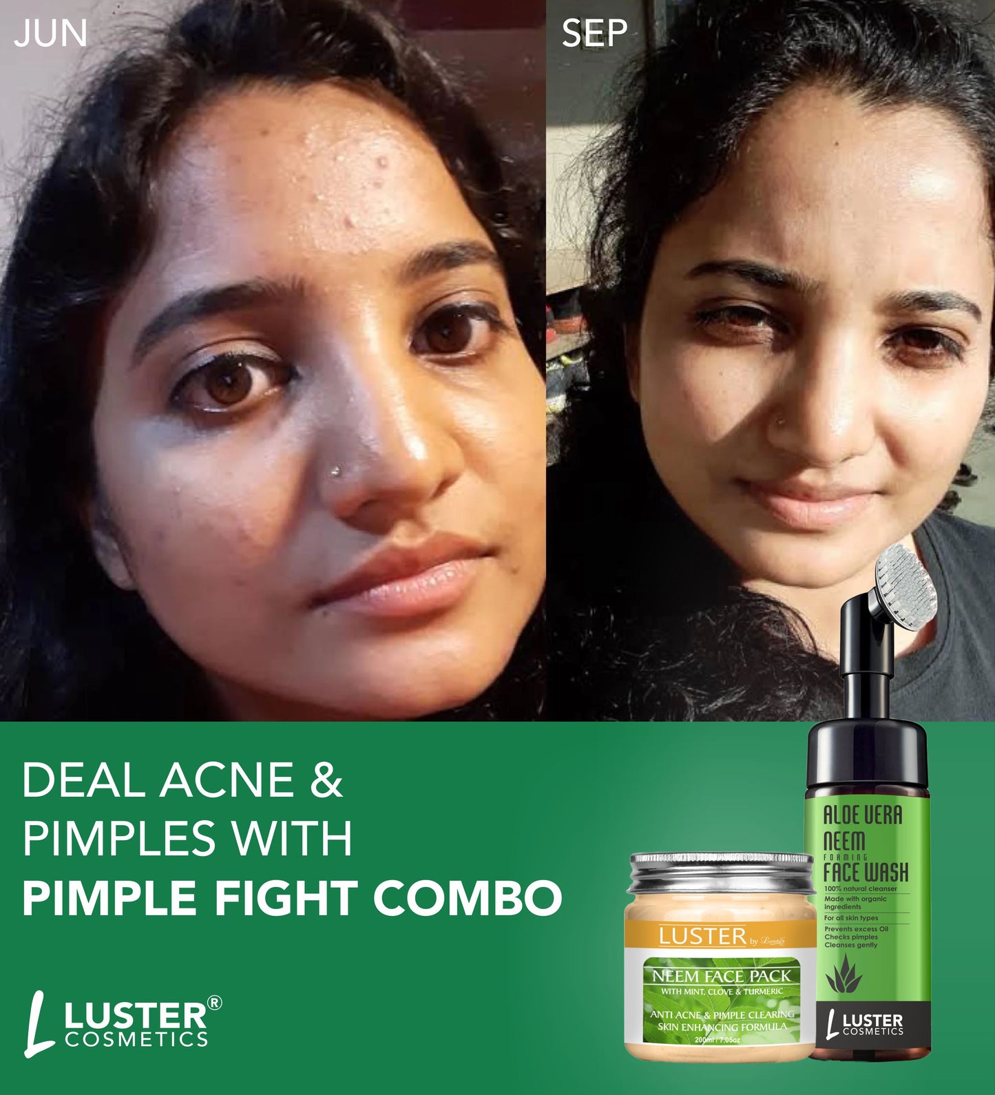 Luster Pimple Fight Combo – Neem Face Pack & Aloe Vera Foaming Face Wash