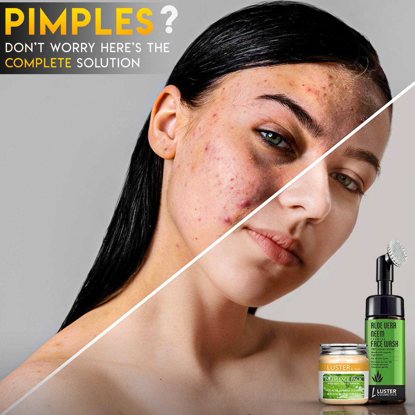 Luster Pimple Fight Combo – Neem Face Pack & Aloe Vera Foaming Face Wash