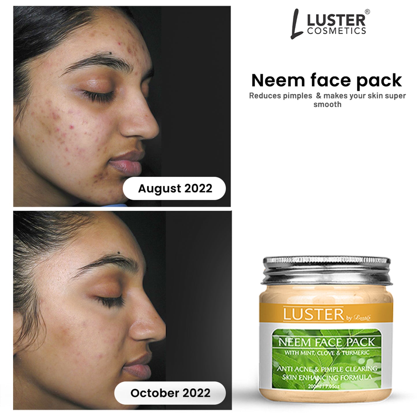 Luster Neem Face Pack - 200g